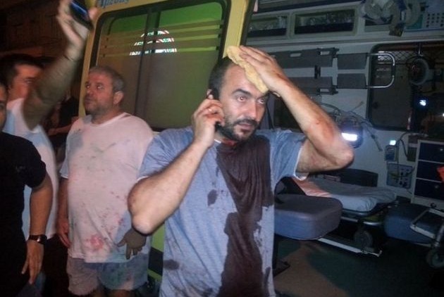 Ο πρόεδρος του Συνδικάτου Μετάλλου και μέλος του ΠΑΜΕ, Σωτήρης Πουλικόγιαννης, χτυπημένος μετά την επίθεση των Χρυσαυγιτών